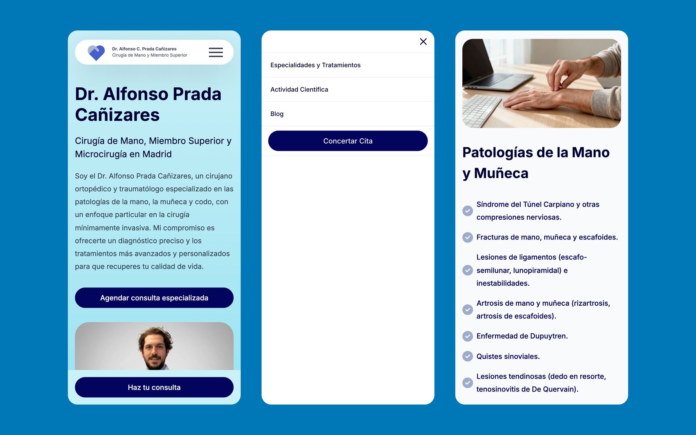 Three mobile screens: home page with a sticky consultation button, full-screen menu and list of hand and wrist conditions.